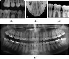 Методы диагностической визуализации в стоматологии